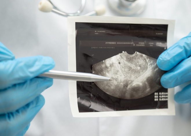 4 types of Mullerian anomalies of the uterus, explained by a doctor