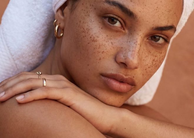 Moles vs. Freckles – Here’s the Difference (And How to Spot When Something’s Wrong)