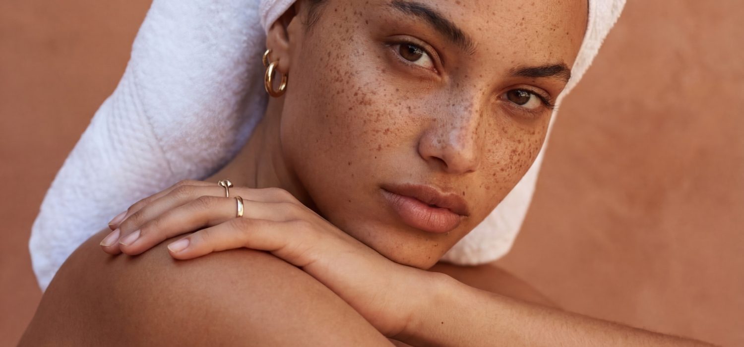 Moles vs. Freckles – Here’s the Difference (And How to Spot When Something’s Wrong)
