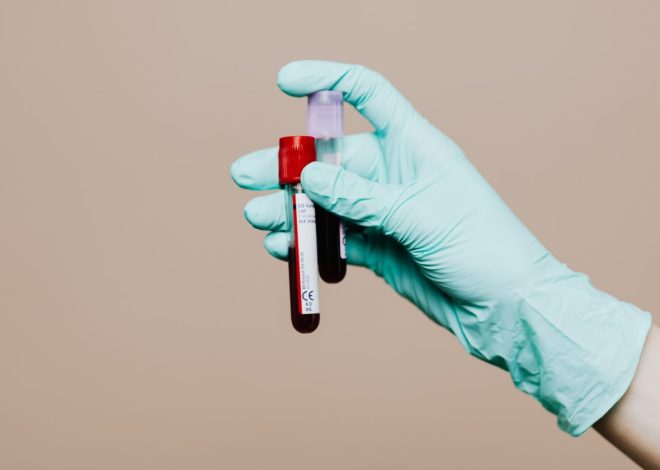My Randox Everywoman Review | Women’s Health Blood Test